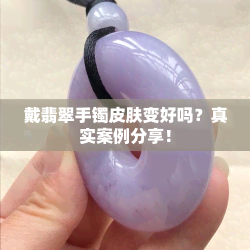 戴翡翠手镯皮肤变好吗？真实案例分享！