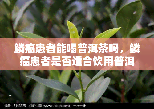 鳞癌患者能喝普洱茶吗，鳞癌患者是否适合饮用普洱茶？