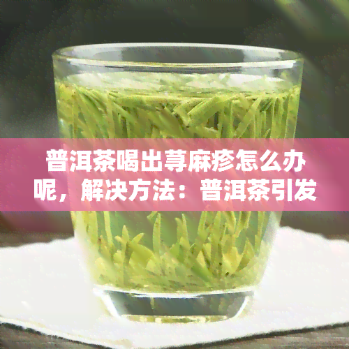 普洱茶喝出荨麻疹怎么办呢，解决方法：普洱茶引发的荨麻疹该如何应对？