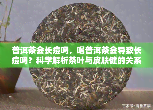 普洱茶会长痘吗，喝普洱茶会导致长痘吗？科学解析茶叶与皮肤健的关系