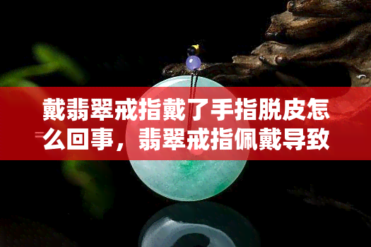 戴翡翠戒指戴了手指脱皮怎么回事，翡翠戒指佩戴导致手指脱皮，原因解析