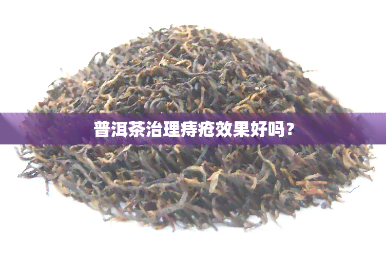 普洱茶治理痔疮效果好吗？