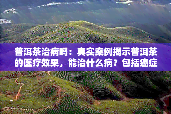 普洱茶治病吗：真实案例揭示普洱茶的医疗效果，能治什么病？包括癌症吗？