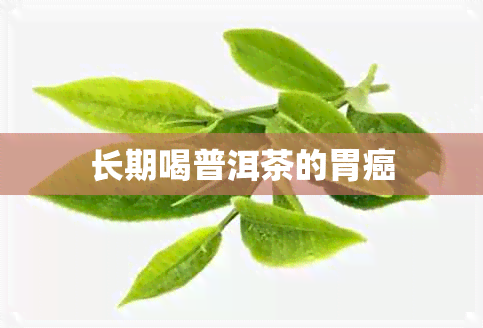 长期喝普洱茶的胃癌