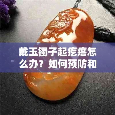 戴玉镯子起疙瘩怎么办？如何预防和处理？