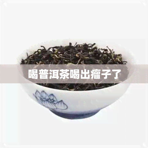 喝普洱茶喝出瘤子了