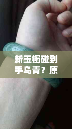 新玉镯碰到手乌青？原因解析及处理方法，让你轻松应对！