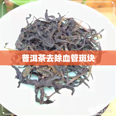 普洱茶去除血管斑块