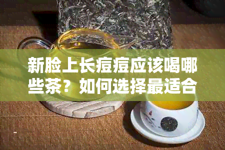 新脸上长痘痘应该喝哪些茶？如何选择最适合的茶来改善皮肤状况？