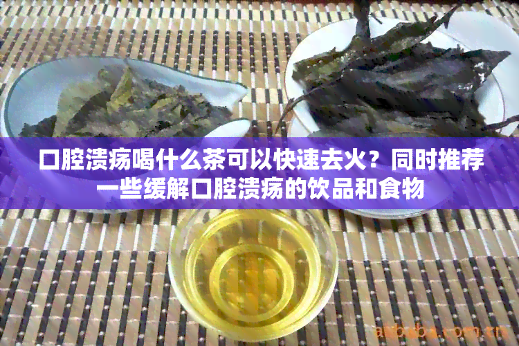 口腔溃疡喝什么茶可以快速去火？同时推荐一些缓解口腔溃疡的饮品和食物