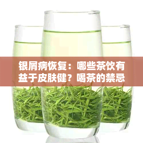 银屑病恢复：哪些茶饮有益于皮肤健？喝茶的禁忌与注意事项又有哪些？