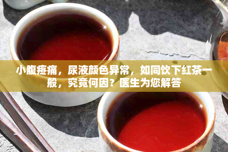 小腹疼痛，尿液颜色异常，如同饮下红茶一般，究竟何因？医生为您解答