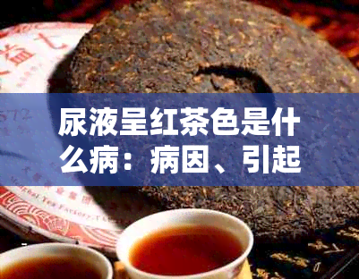 尿液呈红茶色是什么病：病因、引起、症状及解答