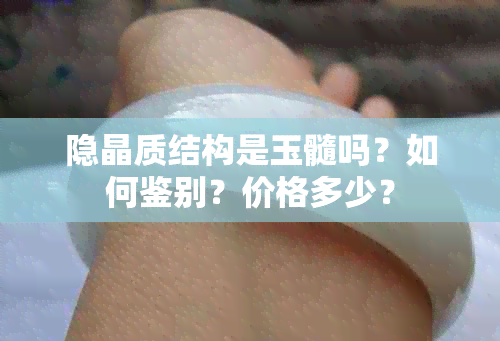 隐晶质结构是玉髓吗？如何鉴别？价格多少？