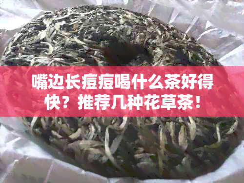 嘴边长痘痘喝什么茶好得快？推荐几种花草茶！