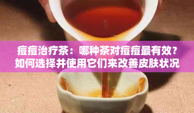 痘痘治疗茶：哪种茶对痘痘最有效？如何选择并使用它们来改善皮肤状况？