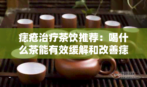 痣疮治疗茶饮推荐：喝什么茶能有效缓解和改善痣疮症状？