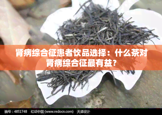 肾病综合征患者饮品选择：什么茶对肾病综合征最有益？