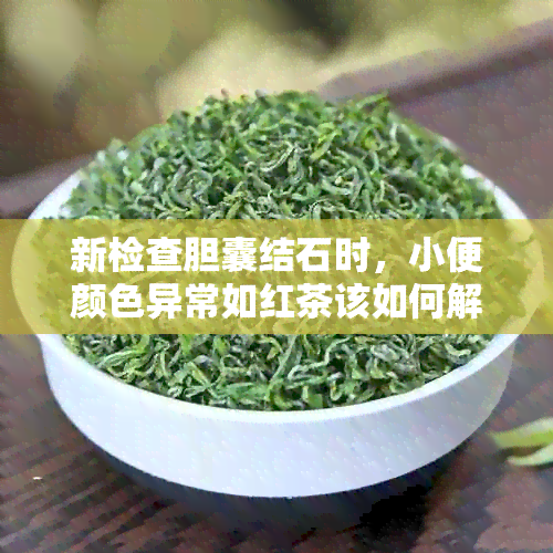 新检查胆囊结石时，小便颜色异常如红茶该如何解读？