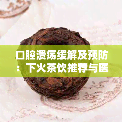 口腔溃疡缓解及预防：下火茶饮推荐与医生建议