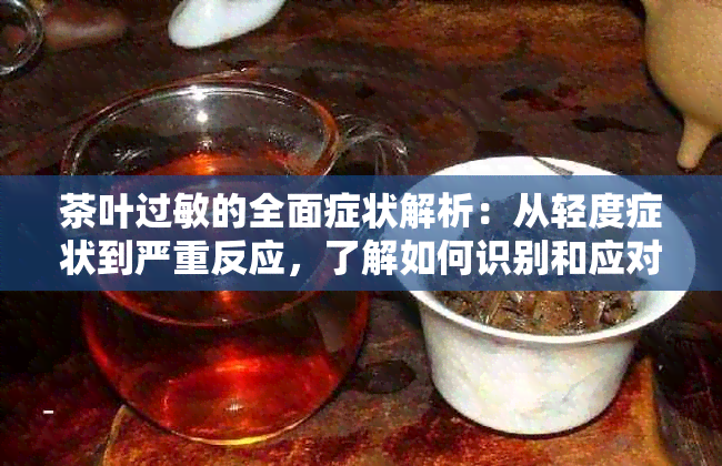 茶叶过敏的全面症状解析：从轻度症状到严重反应，了解如何识别和应对