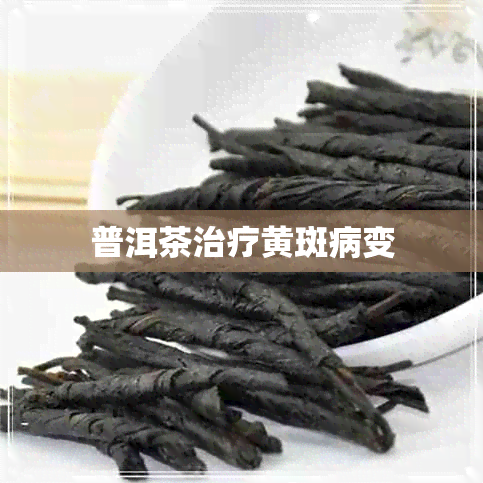 普洱茶治疗黄斑病变