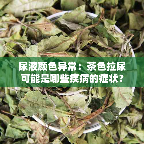 尿液颜色异常：茶色拉尿可能是哪些疾病的症状？