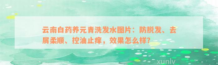 云南白药养元青洗发水图片：防脱发、去屑柔顺、控油止痒，效果怎么样？